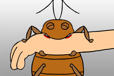 How to Treat Bed Bug Bites